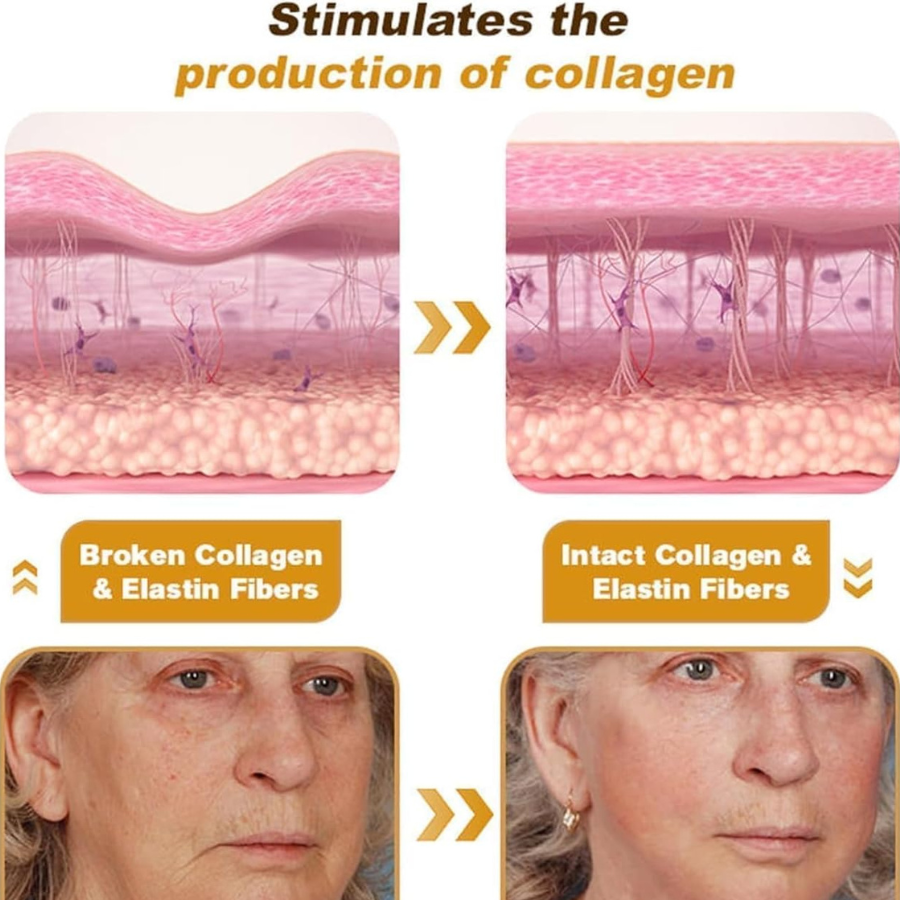 Botox Bee Venom Cream